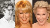 Bette Midler Plastic Surgery Before And After Pictures 2024