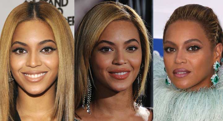 beyonce before and after plastic surgery