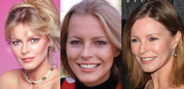 Cheryl Ladd Plastic Surgery Before and After Pictures 2024