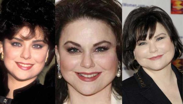 Delta Burke Plastic Surgery Before and After Pictures 2024