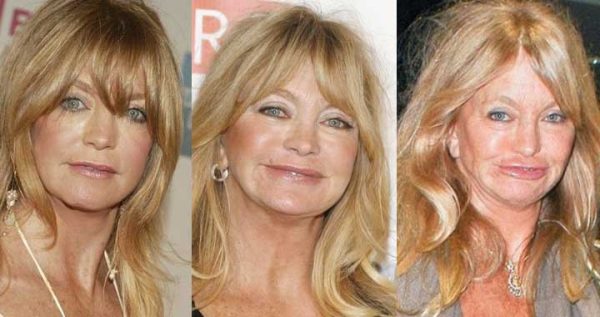 Sela Ward Plastic Surgery Before And After Pictures 2021   Goldie Hawn Plastic Surgery 600x317 