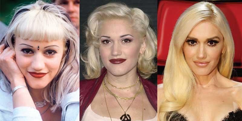 Gwen Stefani Plastic Surgery Before And After Pictures