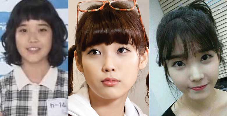 Iu Plastic Surgery Before And After Pictures 2024