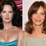 Jaclyn Smith Plastic Surgery