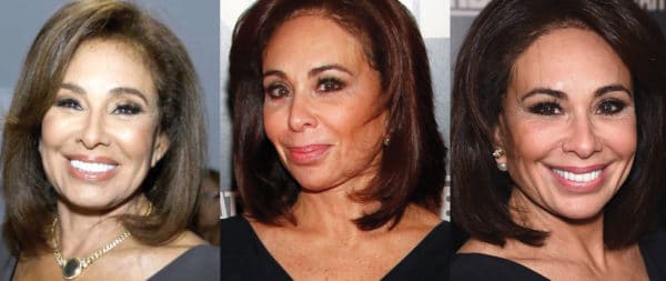 Jeanine Pirro Plastic Surgery Before And After Pictures 2024