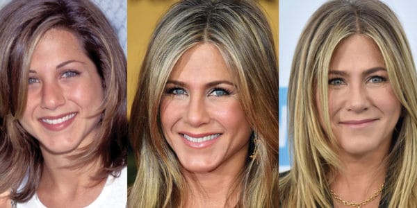 Jennifer Aniston Plastic Surgery Before and After Pictures 2024