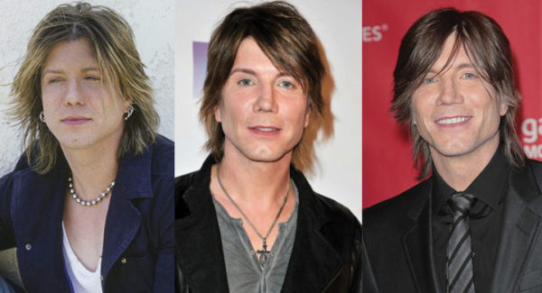 Johnny Rzeznik Plastic Surgery Before and After Pictures 2023