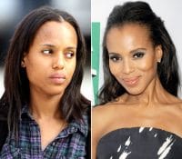 Kerry Washington Plastic Surgery Before and After Pictures 2024