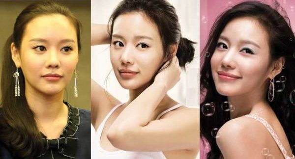 Kim Ah Joong Plastic Surgery Before And After Pictures 2024 7738