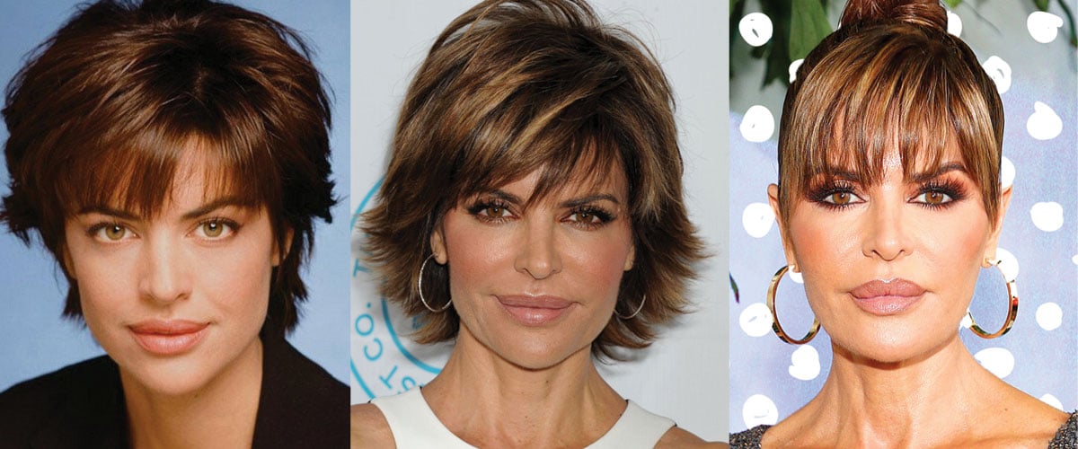 Lisa Rinna Plastic Surgery Before and After Pictures 2024
