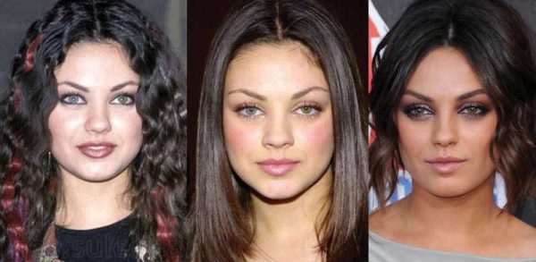 Mila Kunis Plastic Surgery Before And After Pictures