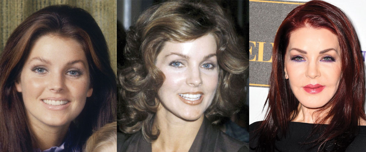 Priscilla Presley Plastic Surgery Before and After Pictures 2020