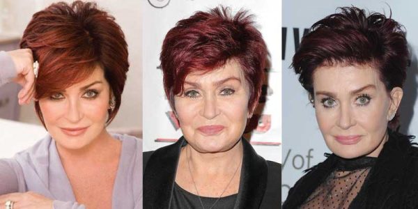 Sharon Osborne Plastic Surgery Before and After Pictures 2024