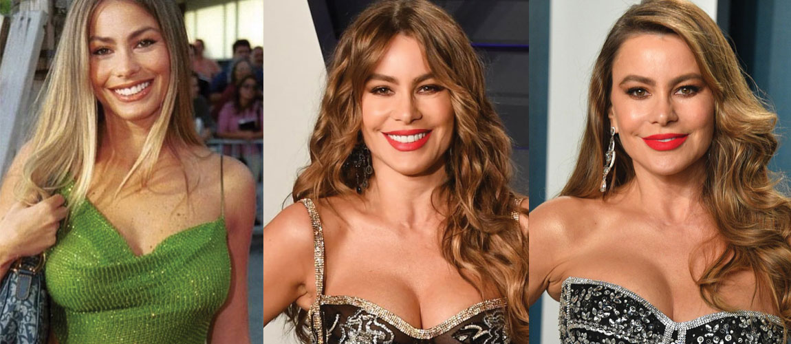 Sofia Vergara Plastic Surgery Before And After Pictures